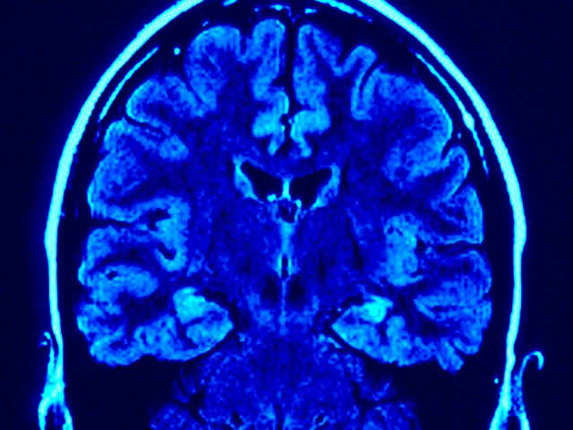 腰痛の原因は脳？腰痛研究の最前線