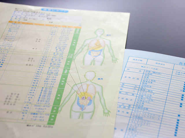 尿1滴でがんリスクが分かる！新しいがん検査「N-NOSE」とは